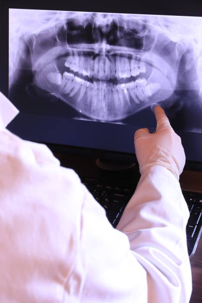 Best Emergency Dental Care for Broken or Chipped Teeth in Riverside, MO
